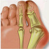 Splint Straightener Corrector