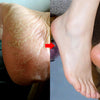 Exfoliating Foot Mask