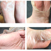 Exfoliating Foot Mask